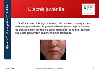 02 juin 2014 Lucie GUEHO - Faculté de Pharmacie 3
MémoireDUHoméopathie2013-2014MémoireDUHoméopathie2013-2014
L'acné juvénile
L'acné est une pathologie cutanée inflammatoire chronique des
follicules pilo-sébacés : la glande sébacée produit trop de sébum,
et simultanément l'orifice du canal folliculaire se ferme, donnant
lieu à une prolifération bactérienne intra-folliculaire.
 