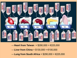 → Heart from Taiwan = $290,000 = €225,000
→ Liver from China = $130,000 = €100,000
→ Lung from South Africa = $290,000 = €225,000
 