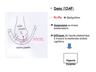 • Dans l’OAP:
- Pc>Pa  déséquilibre
 Surpression au niveau
membranaire
 Diffusion de liquide plasmatique
à travers la membrane alvéolo
capillaire
Hypoxie
Dyspnée
 