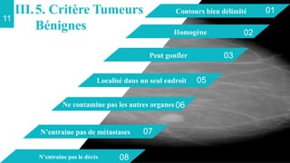 05
Localisé dans un seul endroit
02
Homogène
03
Peut gonfler
01
Contours bien délimité
11
06
Ne contamine pas les autres organes
07
N’entraine pas de métastases
08
N’entraine pas le décès
III.5. Critère Tumeurs
Bénignes
 