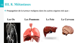 13 III. 8. Métastases
 Propagation de la tumeur malignes dans les autres organes tels que :
Les Os Le Foie Le Cerveau
Les Poumons
 