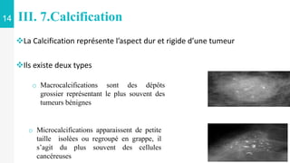 14 III. 7.Calcification
La Calcification représente l’aspect dur et rigide d’une tumeur
Ils existe deux types
o Macrocalcifications sont des dépôts
grossier représentant le plus souvent des
tumeurs bénignes
o Microcalcifications apparaissent de petite
taille isolées ou regroupé en grappe, il
s’agit du plus souvent des cellules
cancéreuses
 