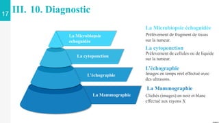 17
III. 10. Diagnostic
La Microbiopsie
echoguidée
La cytoponction
L’échographie
La Mammographie
La Mammographie
Clichés (images) en noir et blanc
effectué aux rayons X
L’échographie
Images en temps réel effectué avec
des ultrasons.
La cytoponction
Prélevement de cellules ou de liquide
sur la tumeur.
La Microbiopsie échoguidée
Prélèvement de fragment de tissus
sur la tumeur.
 