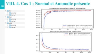 76
VIII. 4. Cas 1 : Normal et Anomalie présente
 