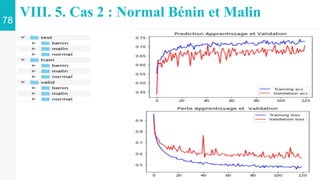78
VIII. 5. Cas 2 : Normal Bénin et Malin
 