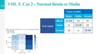 79
VIII. 5. Cas 2 : Normal Bénin et Malin
Valeur prédite
Benin Malin Normal
Vrai valeur
Benin 41 VP 26 97
Malin 31 15 VP 85
Normal 24 6 75 VP
 