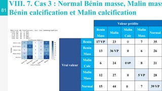 81
VIII. 7. Cas 3 : Normal Bénin masse, Malin mass
Bénin calcification et Malin calcification
Valeur prédite
Benin
Mass
Ma...
