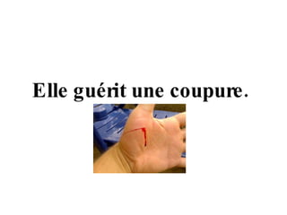 Elle guérit une coupure.  