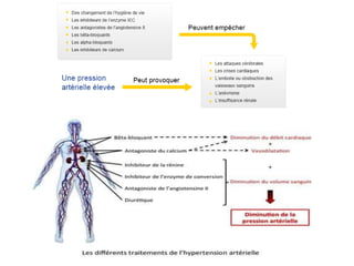 Présentation1 hta ccc