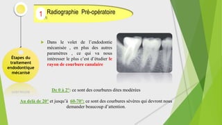  Dans le volet de l’endodontie
mécanisée , en plus des autres
paramètres , ce qui va nous
intéresser le plus c’est d’étudier le
rayon de courbure canalaire
Étapes du
traitement
endodontique
mécanisé
Radiographie Pré-opératoire
(1)
1
De 0 à 2°: ce sont des courbures dites modérées
Au delà de 20° et jusqu’à 60-70°: ce sont des courbures sévères qui devront nous
demander beaucoup d’attention.
 