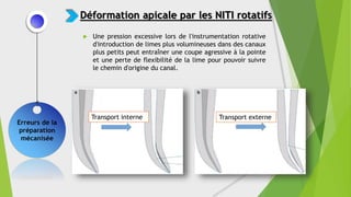  Une pression excessive lors de l'instrumentation rotative
d'introduction de limes plus volumineuses dans des canaux
plus petits peut entraîner une coupe agressive à la pointe
et une perte de flexibilité de la lime pour pouvoir suivre
le chemin d'origine du canal.
Erreurs de la
préparation
mécanisée
Déformation apicale par les NITI rotatifs
Transport interne Transport externe
 