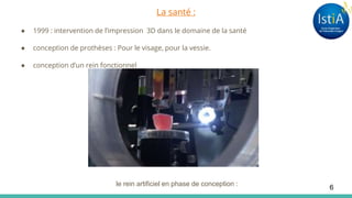 La santé :
● 1999 : intervention de l’impression 3D dans le domaine de la santé
● conception de prothèses : Pour le visage, pour la vessie.
● conception d’un rein fonctionnel
le rein artificiel en phase de conception :
6
 