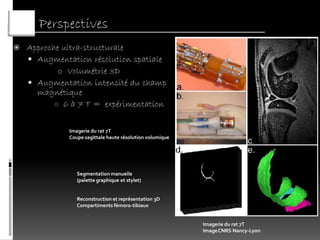 Perspectives
   Approche ultra-structurale
     Augmentation résolution spatiale
            o Volumétrie 3D
     Augmentation intensité du champ
      magnétique
           ○ 6 à 7 T = expérimentation


              Imagerie du rat 7T
              Coupe sagittale haute résolution volumique




                 Segmentation manuelle
                 (palette graphique et stylet)


                 Reconstruction et représentation 3D
                 Compartiments fémoro-tibiaux


                                                           Imagerie du rat 7T
                                                           Image CNRS Nancy-Lyon
 