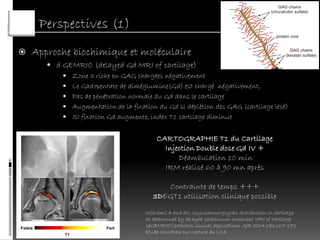 Perspectives (1)
   Approche biochimique et moléculaire
        d GEMRIC (delayed Gd MRI of cartilage)
            Zone 3 riche en GAG chargées négativement
            Le Gadopentate de diméglumine(Gd) est chargé négativement,
            Pas de pénétration normale du Gd dans le cartilage
            Augmentation de la fixation du Gd si déplétion des GAG (cartilage lésé)
            SI fixation Gd augmente, index T1 cartilage diminue


                                          CARTOGRAPHIE T1 du Cartilage
                                            Injection Double dose Gd IV +
                                                Déambulation 10 min
                                            IRM réalisé 60 à 90 mn après

                                             Contrainte de temps +++
                                         3DEGT1 utilisation clinique possible
                                      Williams A and all; Glycosaminoglycan distribution in cartilage
                                      as determined by delayed gadolinium-enhanced MRI of cartilage
                                      (dGEMRIC):potential clinical applications ,AJR 2004;182:167-172
                                      Etude chondrale sur rupture du LCA
 