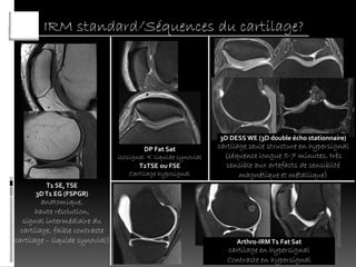 IRM standard/Séquences du cartilage?




                                                               3D DESS WE (3D double écho stationnaire)
                                         DP Fat Sat            cartilage seule structure en hypersignal
                                isosignal < liquide synovial     (séquence longue 5-7 minutes, très
                                       T2TSE ou FSE               sensible aux artefacts de sensibilté
                                    Cartilage hyposignal              magnétique et métallique)
         T1 SE, TSE
      3D T1 EG (FSPGR)
         anatomique,
       haute résolution,
   signal intermédiaire du
  cartilage, faible contraste
cartilage – liquide synovial)                                       Arthro-IRM T1 Fat Sat
                                                                 cartilage en hypersignal
                                                                 Contraste en hypersignal
 