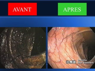 9:9;<                    95=>-
        L'intérieur de
          l'intestin




                             ")
 