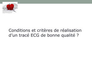 Conditions et critères de réalisation
d’un tracé ECG de bonne qualité ?
 