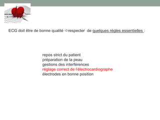 repos strict du patient
préparation de la peau
gestions des interférences
réglage correct de l’électrocardiographe
électrodes en bonne position
ECG doit être de bonne qualité respecter de quelques règles essentielles :
 