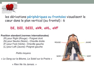 les dérivations périphériques ou frontales visualisent le
cœur dans le plan vertical (ou frontal) : 6
DI, DII, DIII, aVR, aVL, aVF
Position standard (normes internationales)
(R) pour Right (Rouge) - Poignet droit
(N) pour Neutre (Noire) - Cheville droite
(F) pour Foot (Verte) - Cheville gauche
(L) pour Left (Jaune)- Poignet gauche
Petits moyens
« Le Sang sur la Bitume, Le Soleil sur la Prairie »
« Rien Ne Va Jamais. »
 