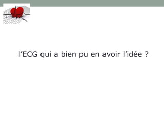 l’ECG qui a bien pu en avoir l’idée ?
 