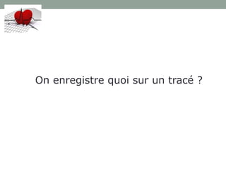 On enregistre quoi sur un tracé ?
 