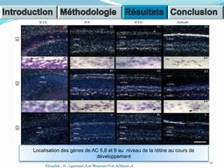Localisation des gènes de AC 5,8 et 9 au niveau de la rétine au cours de
développement
10
Eloualidi , H ; Lguensat ,A et Mnaouer N et Achbani ,A
 