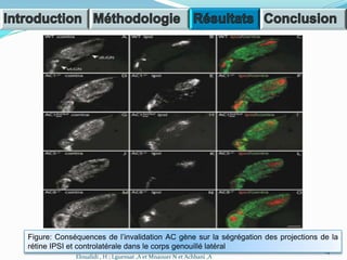 14
Eloualidi , H ; Lguensat ,A et Mnaouer N et Achbani ,A
Figure: Conséquences de l’invalidation AC gène sur la ségrégation des projections de la
rétine IPSI et controlatérale dans le corps genouillé latéral
 