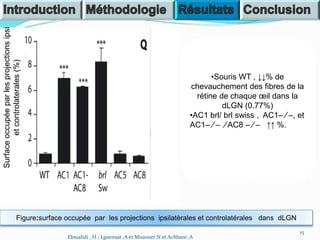 Figure:surface occupée par les projections ipsilatèrales et controlatérales dans dLGN
•Souris WT , ↓↓% de
chevauchement des fibres de la
rétine de chaque œil dans la
dLGN (0.77%)
•AC1 brl/ brl swiss , AC1– ⁄ –, et
AC1– ⁄ – ⁄ AC8 – ⁄ – ↑↑ %.
15
Eloualidi , H ; Lguensat ,A et Mnaouer N et Achbani ,A
Surfaceoccupéeparlesprojectionsipsi
etcontrolaterales(%)
 