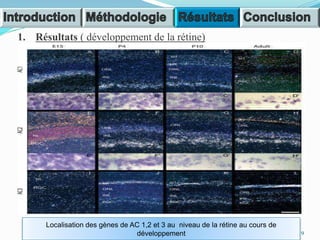 1. Résultats ( développement de la rétine)
Localisation des gènes de AC 1,2 et 3 au niveau de la rétine au cours de
développement 9
 