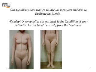 Our technicians are trained to take the measures and also to
                        Evaluate the Needs.

   We adapt & personalize our garment to the Condition of your
      Patient so he can benefit entirely from the treatment




13/02/13                                                            52
 