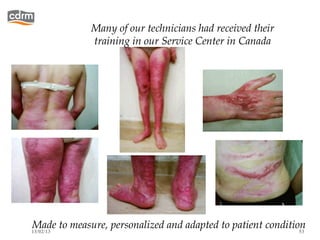 Many of our technicians had received their
             training in our Service Center in Canada




Made to measure, personalized and adapted to patient condition
13/02/13                                                     53
 