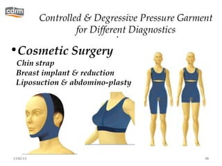Controlled & Degressive Pressure Garment
                    for Different Diagnostics
                               .
•Cosmetic Surgery
 Chin strap
 Breast implant & reduction
 Liposuction & abdomino-plasty




                                     3 months



13/02/13                                         58
 