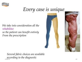Every case is unique.


We take into consideration all the
rehabilitee
so the patient can benefit entirely
From the prescription




     Several fabric choices are available
     according to the diagnostic
  13/02/13                                  63
 