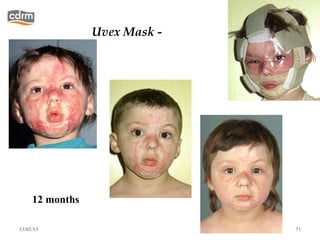 Uvex Mask -




     12 months

13/02/13                       71
 