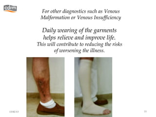For other diagnostics such as Venous
            Malformation or Venous Insufficiency

             Daily wearing of the garments
             helps relieve and improve life.
           This will contribute to reducing the risks
                   of worsening the illness.




13/02/13                                                77
 