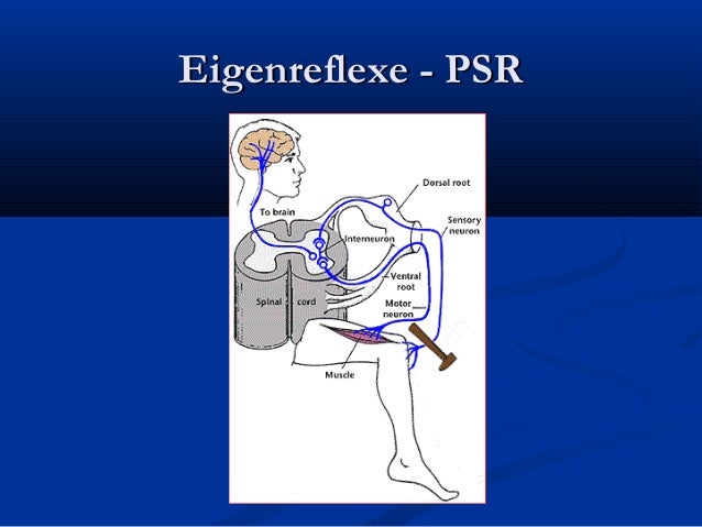 Asr Reflex Nicht Auslösbar Präsentation neurologie 1