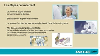 Les étapes de traitement

  La première étape: entretien
  personnel avec le dentiste

  Etablissement du plan de traitement

  La pose de l’implant est exactement planifiée à l’aide de la radiographie

  Afin de pouvoir juger précisément l’état
  de l’os et la localisation d’autres structures importantes,
  un scanner, ou examen tomodensitométrique,
  est parfois nécessaire.
 