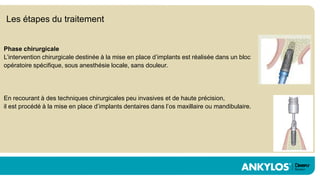 Les étapes du traitement


Phase chirurgicale
L’intervention chirurgicale destinée à la mise en place d’implants est réalisée dans un bloc
opératoire spécifique, sous anesthésie locale, sans douleur.




En recourant à des techniques chirurgicales peu invasives et de haute précision,
il est procédé à la mise en place d’implants dentaires dans l’os maxillaire ou mandibulaire.
 