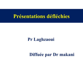 Présentations défléchies
Pr Laghzaoui
Diffuée par Dr makani
 