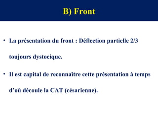 B) Front
• La présentation du front : Déflection partielle 2/3
toujours dystocique.
• Il est capital de reconnaître cette présentation à temps
d’où découle la CAT (césarienne).
 