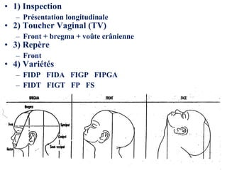 • 1) Inspection
– Présentation longitudinale
• 2) Toucher Vaginal (TV)
– Front + bregma + voûte crânienne
• 3) Repère
– Front
• 4) Variétés
– FIDP FIDA FIGP FIPGA
– FIDT FIGT FP FS
 