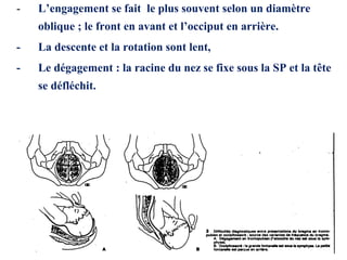 - L’engagement se fait le plus souvent selon un diamètre
oblique ; le front en avant et l’occiput en arrière.
- La descente et la rotation sont lent,
- Le dégagement : la racine du nez se fixe sous la SP et la tête
se défléchit.
 
