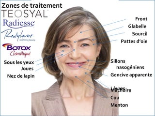 Sillons nasogéniens Gencive apparente  Lèvres  Front Glabelle  Sourcil Pattes d’oie Mâchoire Cou Menton Zones de traitement Sous les yeux Joues Nez de lapin 