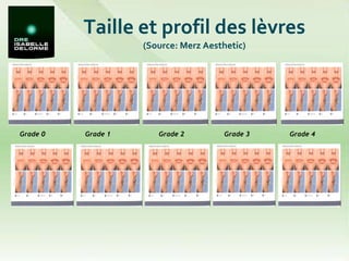 Taille et profil des lèvres (Source: Merz Aesthetic) Grade 0 Grade 2 Grade 1 Grade 4 Grade 3 
