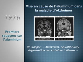 Mise en cause de l’aluminium dans  la maladie d’Alzheimer Dr Crapper:  « Aluminium, neurofibrillarydegeneration and Alzheimer’sdisease » 1976 Premiers soupçons sur l’aluminium 