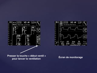 Presser la touche « début ventil »
pour lancer la ventilation
Écran de monitorage
 