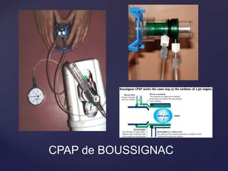 CPAP de BOUSSIGNAC
 