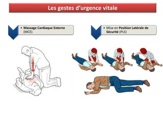 Les gestes d’urgence vitale
• Massage Cardiaque Externe
(MCE)
• Mise en Position Latérale de
Sécurité (PLS)
 