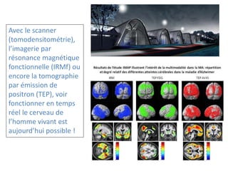 Avec le scanner
(tomodensitométrie),
l’imagerie par
résonance magnétique
fonctionnelle (IRMf) ou
encore la tomographie
par émission de
positron (TEP), voir
fonctionner en temps
réel le cerveau de
l’homme vivant est
aujourd’hui possible !
 
