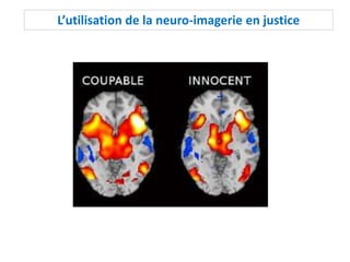 L’utilisation de la neuro-imagerie en justice
 
